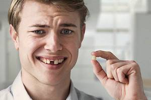 Как удалить зуб