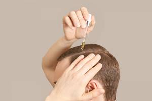 Как предотвратить выпадение волос из–за стресса