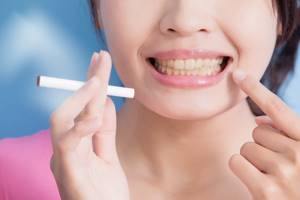 Как отбелить зубы если вы курите