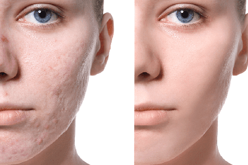 Как вылечить разрыв кожи